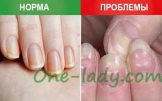 Виды деформаций ногтевой пластины. Диагностика и лечение болезни.